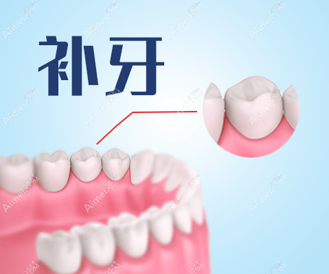 20260803613069.png 补牙.png