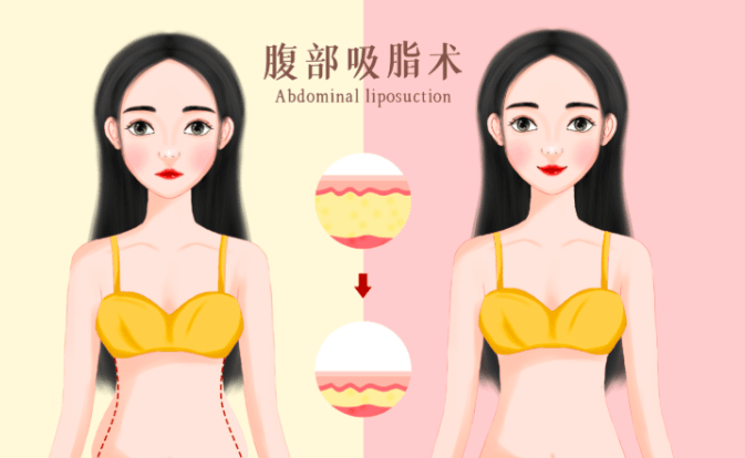 五、金华丽都激光吸脂真实用户常见疑问解答(FAQ)