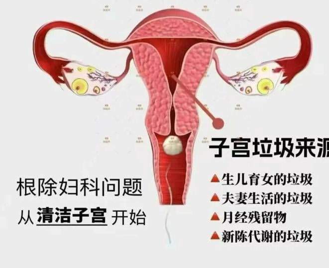 4. 乳头乳晕缩小术
