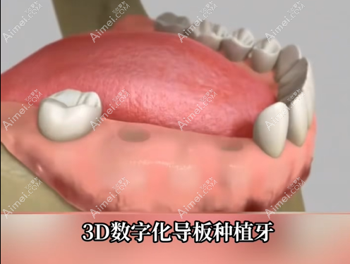 20260806781728.png image.png