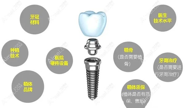 准备去鼎植口腔种牙?先上贝色查好收费,再领看牙优惠券,省的都是真金白银