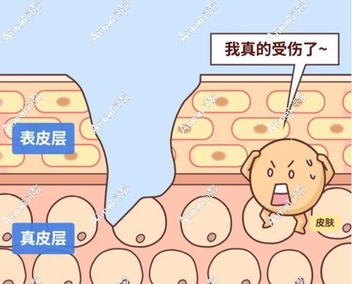 一、苏州祛疤痕手术治疗费用www.dlren.com