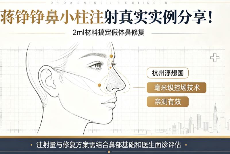 蒋铮铮鼻小柱注射真实实例分享!2ml材料搞定假体鼻修复,杭州浮想国毫米级控场技术亲测有效!