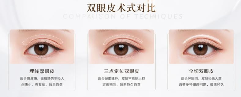 二、深入拆解:杜院长擅长的双眼皮术式与适合人群画像www.dlren.com