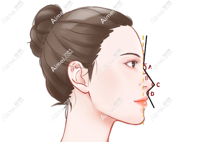 王全俊隆鼻 王全俊隆鼻