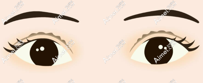 王全俊眼整形 王全俊眼整形