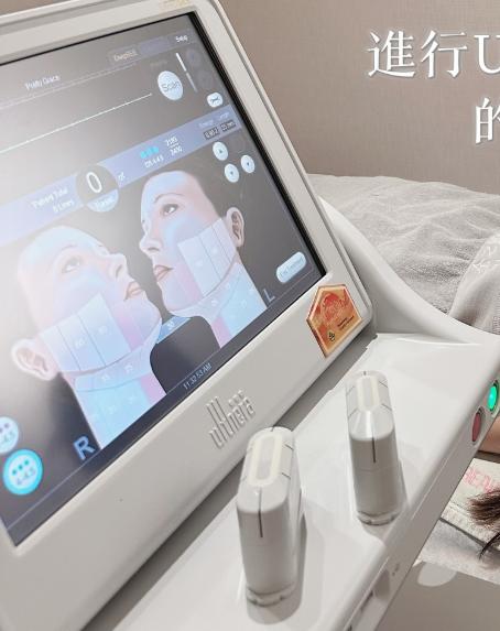全之妍Ultherapy美刀