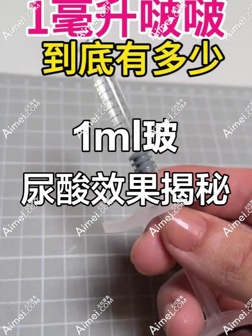 玻尿酸注射 玻尿酸注射