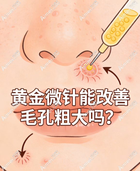 黄金微针改善毛孔粗大 黄金微针改善毛孔粗大