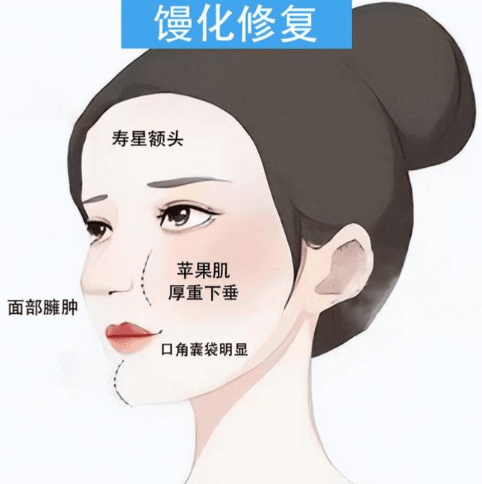 二、如何深度评估一位医生是否擅长馒化脸修复