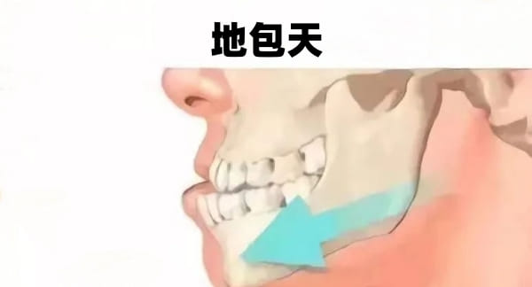 三、柳州矫正牙齿好的医院延伸关注:多少钱做矫正更合理?公立私立如何选?