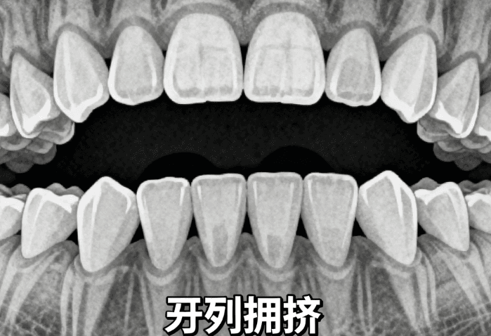 七、上饶牙博仕口腔医院正畸医生名单患者真实反馈