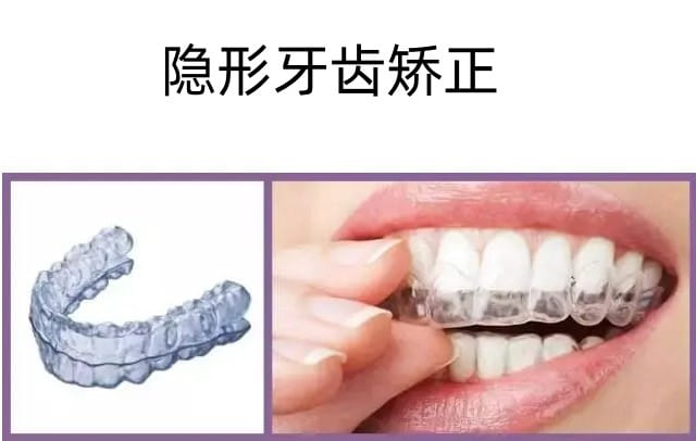 二、上饶牙博仕口腔医院正畸医生排班表怎么查更准