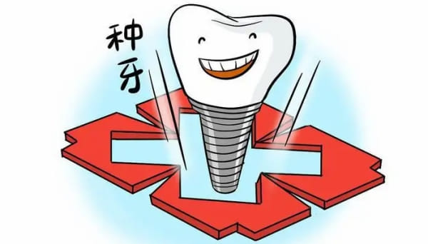三、吉安博恩口腔种植牙价格里,国产、韩国、欧美种植体怎么选?