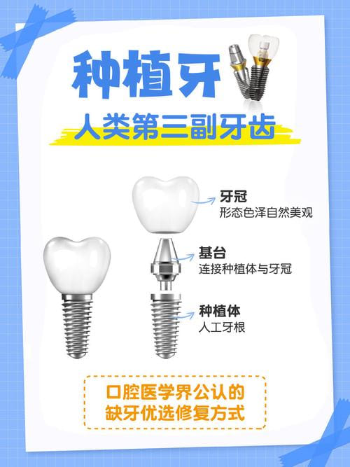 三、盐城东台固德熊猫口腔2026年种牙预约胡医生要提前几天