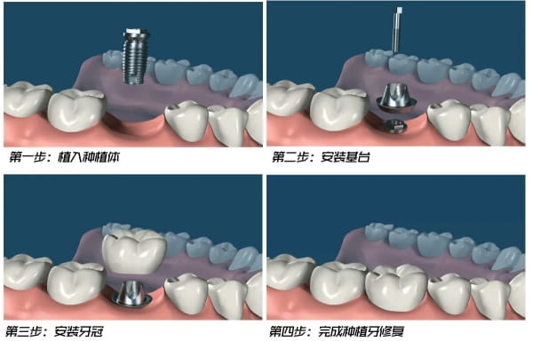 六、长春中大口腔常见问题解答