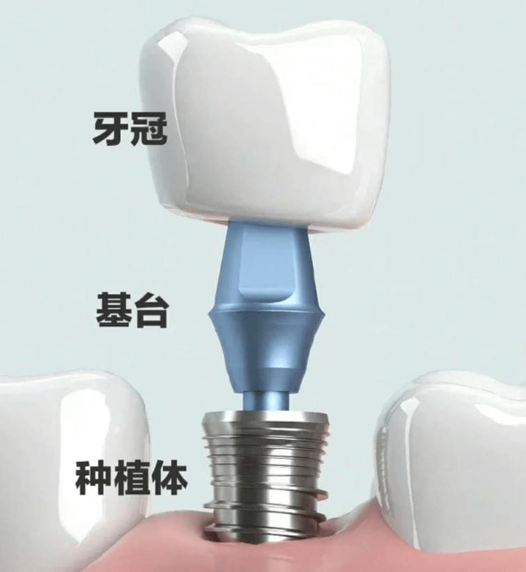 三、西安诺贝尔口腔医院儿牙早矫选高静副主任靠谱吗